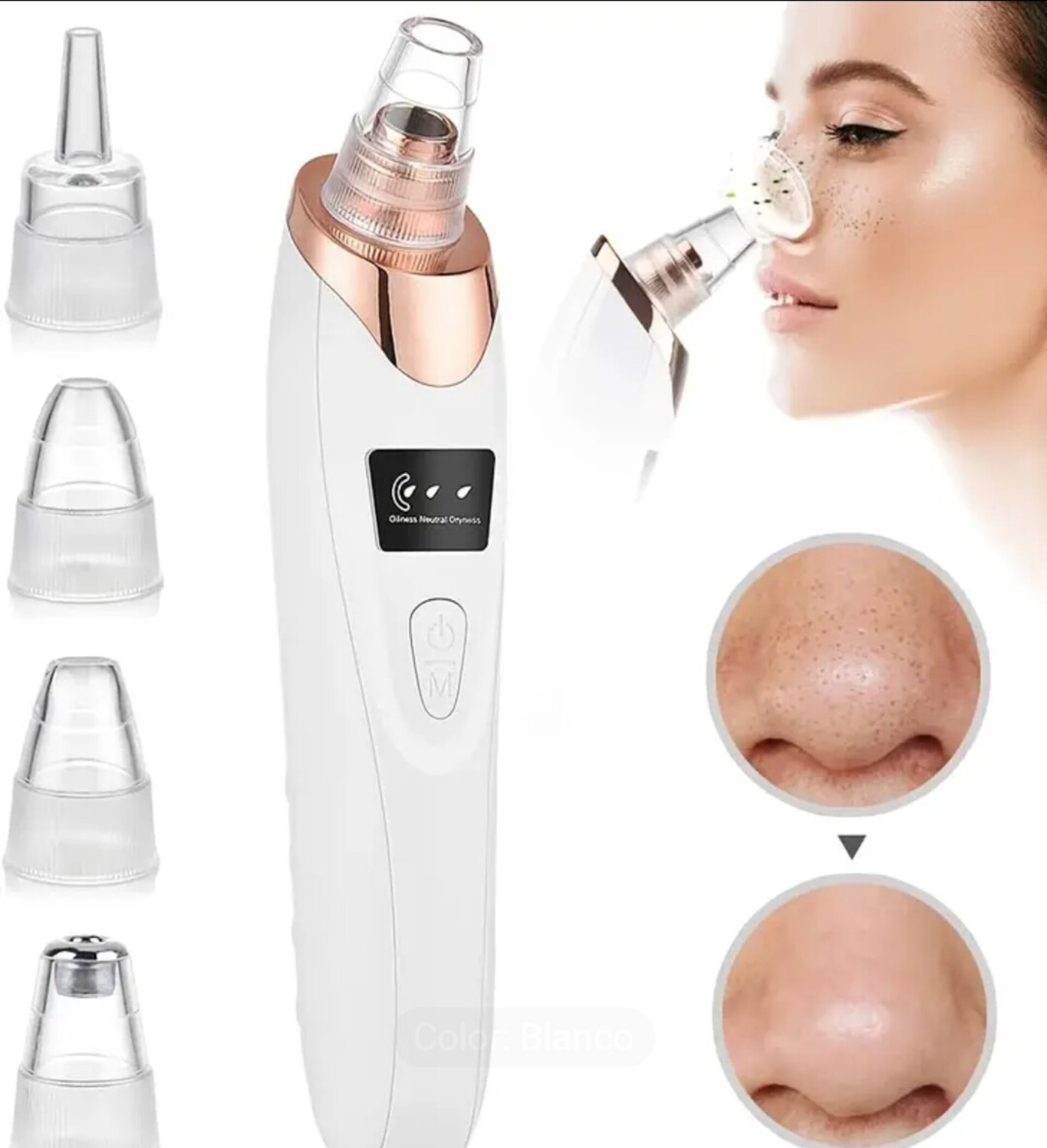 Maquina Aspiradora De Puntos Negros - 7